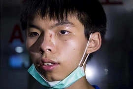 Thủ lĩnh sinh viên của Hong Kong bị tấn công giữa phố