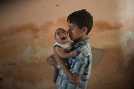 Colombia: Hơn 2.100 phụ nữ mang thai nhiễm virus Zika