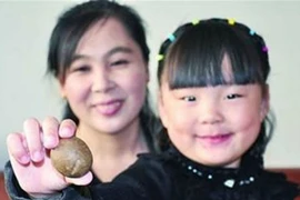 Phát hiện viên sỏi cực quý trong gan cừu