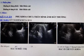 'Thầy tâm linh' chữa hiếm muộn, đi đẻ mới biết… không có thai