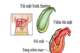 (Hình minh họa)