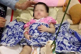Bé gái bị mẹ nuôi đánh gãy chân: Nụ cười bé thơ và nỗi xót xa