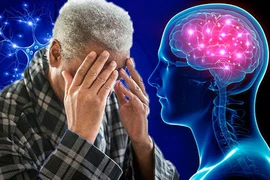 Hay quên có phải bị sa sút trí tuệ?
