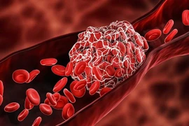 Từng tiêm vaccine AstraZeneca, giờ có nên uống thuốc tan cục máu đông?