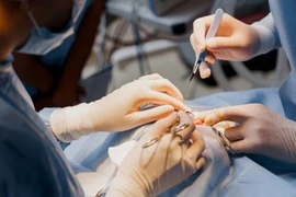 Chưa đầy 1 năm, TP.HCM ghi nhận 15 ca tai biến phẫu thuật thẩm mỹ