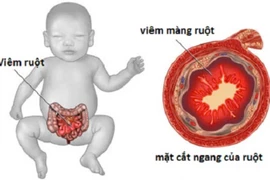 (Ảnh minh họa)
