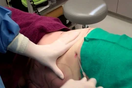 1 phụ nữ bị nhiễm trùng, suy tim sau phẫu thuật hút mỡ bụng