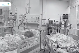 2 chị em bị bỏng nặng nghi do cha ruột phóng hỏa