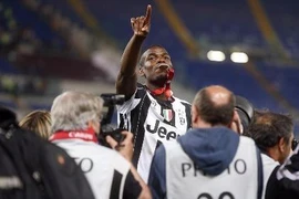 Paul Pogba và top 10 vụ chuyển nhượng đắt giá nhất 