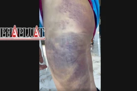 UBND huyện Lâm Hà báo cáo vụ học sinh lớp 6 bị đánh