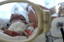 Bé Salvador đang được chăm sóc đặc biệt tại bệnh viện. Ảnh: BBC
