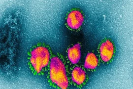Không chặn được đà lây nhanh sẽ không kiểm soát nổi dịch virus corona. Ảnh: EYE OF SCIENCE