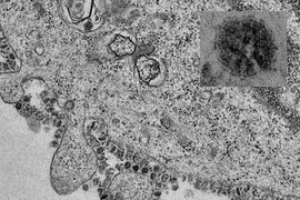 Đại học Hong Kong công bố những hình ảnh đầu tiên về quá trình phân bào của virus 2019-nCoV. Ảnh: BLOOMBERG