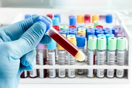 Người có nhóm máu A sẽ dễ nhiễm và có triệu chứng nặng hơn, nghiên cứu của các nhà khoa học Trung Quốc cho biết. Ảnh: GETTY IMAGES