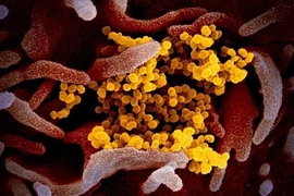 Virus SARS-CoV-2 (màu vàng) được phân lập dưới kính hiển vi điện tử. Ảnh: LIVE SICIENCE 