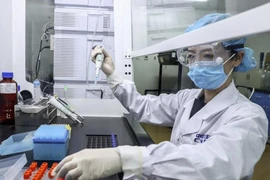 Các nước đang nỗ lực tìm ra vaccine để chấm dứt đại dịch. Ảnh: AP