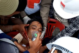 Một người biểu tình Myanmar bị thương do trúng đạn cảnh sát ở TP Yangon ngày 28-2. Ảnh: THE NEW YORK TIMES