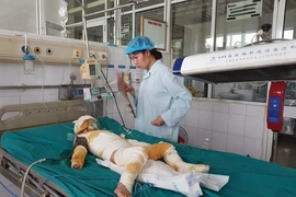 Sức khỏe 3 trẻ bị bỏng nặng vụ cô giáo dùng cồn dạy PCCC