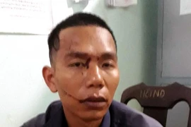 Bắt tại trận vợ ngoại tình, chồng chém tử vong tình địch