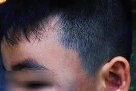 Gia đình cháu bé bị xe ôm đánh muốn tòa xử công khai 
