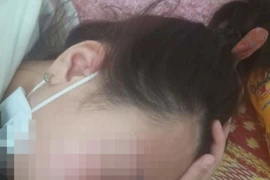 Nạn nhân TBTL (học lớp 10) bị chấn động não. 