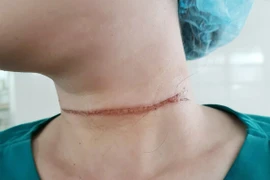 Cảnh báo tai nạn từ thả diều