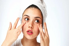 5 cách 'đánh bại' mụn khi thường xuyên mang khẩu trang