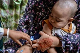 Bùng phát dịch sởi ở Bangladesh, hơn 500 trẻ em tử vong