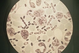 Sốc: vi khuẩn gây chết người 'núp' trong phòng thí nghiệm hàng trăm năm