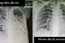 Chuyên gia: Cần rút ngắn khoảng cách giữa 2 mũi vaccine Astrazeneca ở 'vùng đỏ'