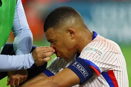 Mbappe rời sân với cái mũi đầy máu, đội tuyển Pháp thiệt hại nặng nề