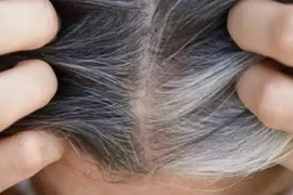 3 loại phụ liệu thực phẩm giúp ngăn ngừa tóc bạc sớm