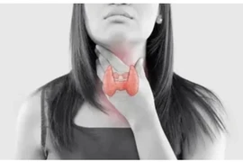 Những cách tự nhiên để ngăn ngừa bệnh tuyến giáp