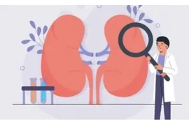 7 sai lầm trong lối sống khiến thận bị tổn thương