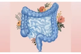 6 loại thực phẩm thay thế lành mạnh để hỗ trợ sức khỏe đường ruột