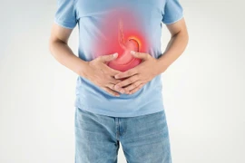 5 lời khuyên giúp ngăn ngừa tình trạng trào ngược axit trong mùa hè