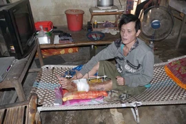 Suýt mất chân, tay bởi... bác sĩ