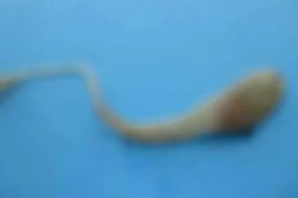 Hi hữu: Trứng rắn sống trong trứng gà