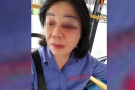 Công an điều tra vụ nữ tiếp viên xe buýt bị đánh