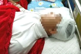 Nam sinh Phan Thanh L. đang được điều trị tích cực tại Bệnh viện Đa khoa tỉnh Thanh Hóa. Ảnh: BV 