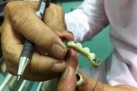 Sặc nước, trôi nguyên hàm răng giả vào cổ họng