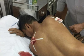 Bị chém trọng thương vì qua... nhắc nhở hàng xóm