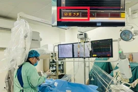 2 người dùng dao giải quyết mâu thuẫn từ tiệc cưới