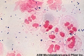 Kẻ gây vô sinh giấu mặt và bất ngờ