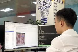 VinBrain sử dụng 'siêu máy tính' cho các giải pháp ứng dụng AI