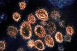 Ảnh chụp virus SARS-CoV-2 thông qua kính hiển vi. Ảnh: AP