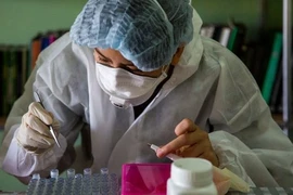 Virus Langya henipavirus (LayV) là loại virus lây từ động vật sang người, thuộc họ virus Paramyxoviridae có thể gây chết người. Ảnh: GETTY IMAGES