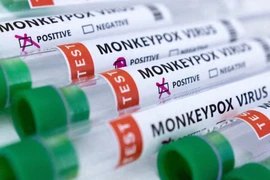 Kit test đậu mùa khỉ. ẢNH: REUTERS