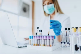 Phát hiện đột phá giúp chẩn đoán sớm bệnh mất trí nhớ Alzheimer từ 10-15 năm