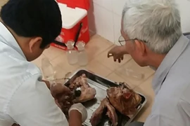 Nhiều người ở Bình Phước bị 'dính' sán dây heo